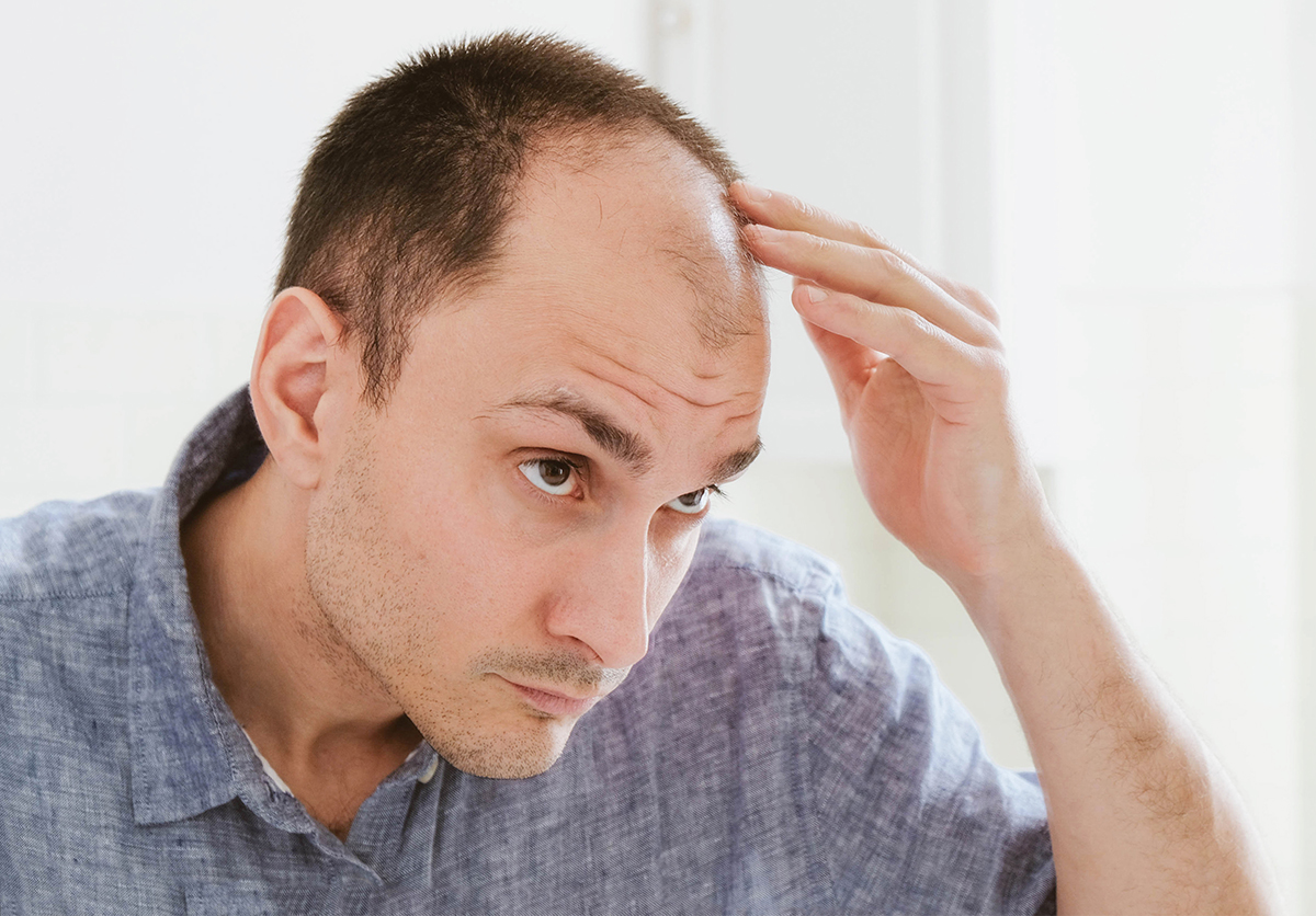 Featured image for “Hair Loss in Men and Women: The Root Causes No One Talks About”